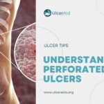 Understanding Perforated Ulcers